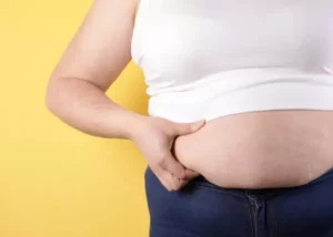How Much Weight Can You Lose with a Tummy Tuck